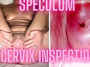 extrême, chatte-pussy, maman, hôpital, examen-gyno, diffusion